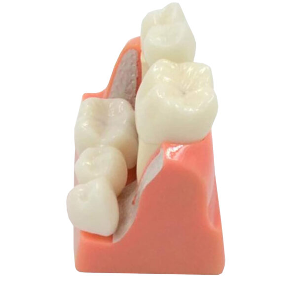 Model implantu dentystycznego jamy ustnej model zębów - obrazek 3