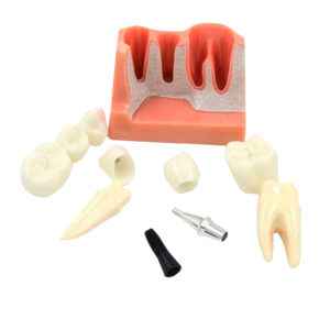 Model implantu dentystycznego jamy ustnej model zębów